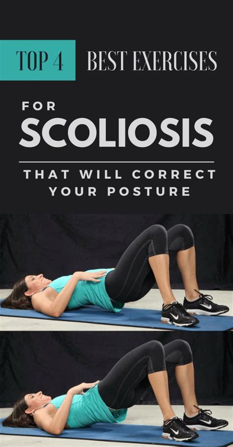 top 4 best exercises for scoliosis that will correct your posture scoliosis exercises