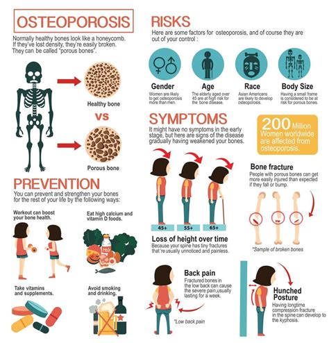 Osteoporosis Treatment In Jackson Madison Ms