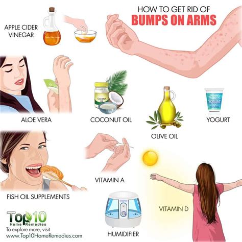Bumps On Arms Treatment Home Remedies And Self Care Tips Bumps On