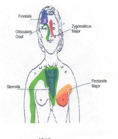 Shoulder tendonitis goes beyond everyday shoulder pain. Head, Neck, and Shoulder Trigger Point Chart 5 © Copyright American Academy of Manual Medicine