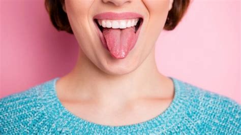 What Your Tongue Reveals About Your Health