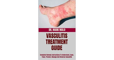 Vasculitis Treatment Guide Complete Remedy Instructions To Understand Cope Treat Prevent