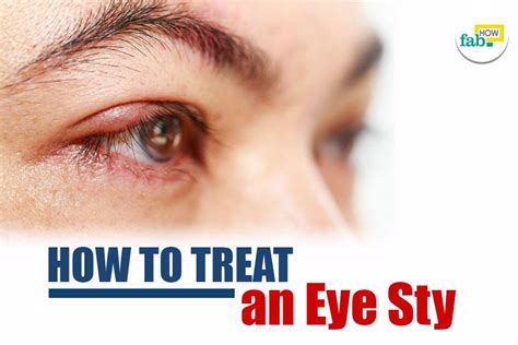 Super Easy Way To Treat An Eye Sty Fast Fab How
