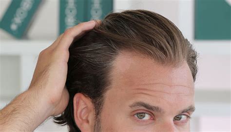 The Best Hairstyles For A Receding Hairline 2020 Haircut Styles