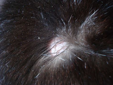 Cats can get fleas fleas at kennels, groomers, or outside. My cat has got two bald patches on his back, both at ...