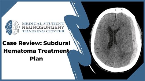 Case Review Subdural Hematoma Treatment Plan Youtube