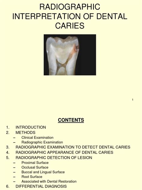 Radiographic Interpretation Of Dental Caries Dental Ebook And Lecture