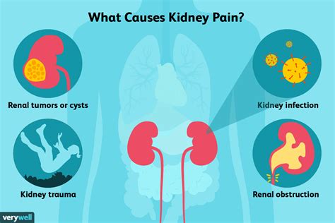 Picture Of Where Kidney Pain Is Felt کامل هلپ کده