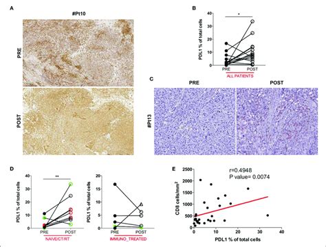 Hla Class I And Pdl1 Expression In Serial Tumor Biopsies From Dc