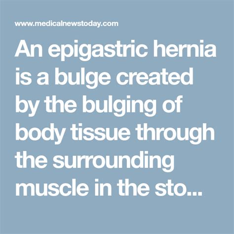 An Epigastric Hernia Is A Bulge Created By The Bulging Of Body Tissue