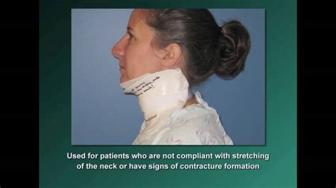 Burns 405 Neck Splint Youtube