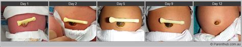 Your baby's stump will dry out and drop off any time between five days and 15. Video: Umbilical Cord | Parenthub