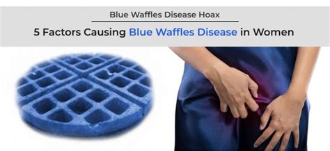 Factors Causing Blue Waffles Disease In Women