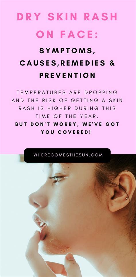 Pin On Skincare Tips