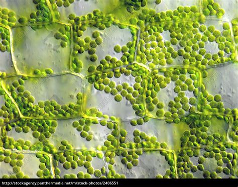 Microscope Chloroplast In Plant Cell Micropedia