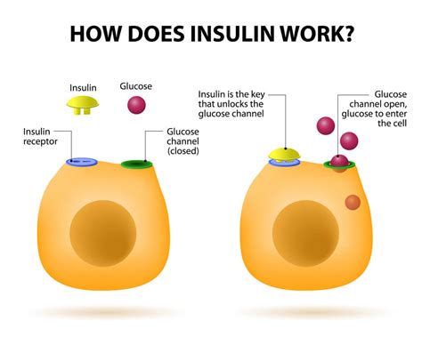 Insulin Resistance Is A Strong Predictor Of Disease Here S What You Need To Know Forks Over