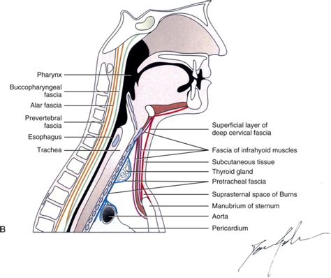 Ludwigs Angina Pocket Dentistry