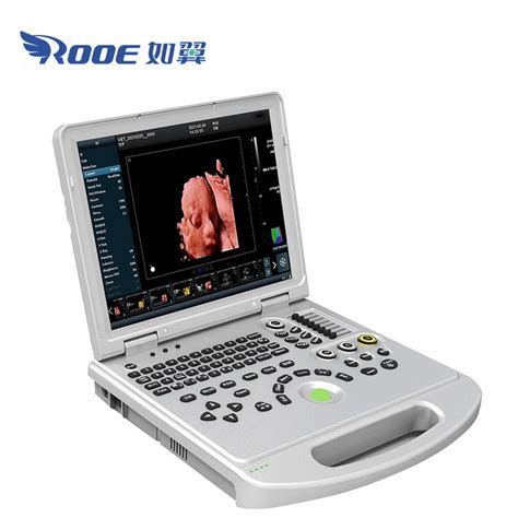 Usc60plus Pro Middle End Laptop Color Doppler 4d Ultrasonic Scanner