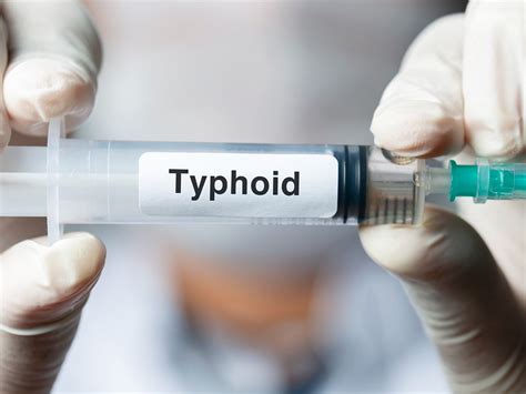 Typhoid Fever Causes Symptoms Diagnosis Treatment And Management
