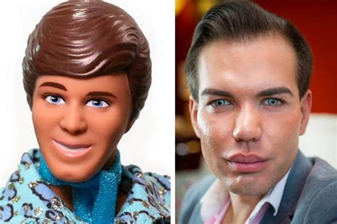 surgery addict spent £100 000 on ops botox and fillers to look like a real life ken doll