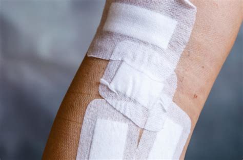 Tips For Open Wound Care After Surgery First Aid Reference