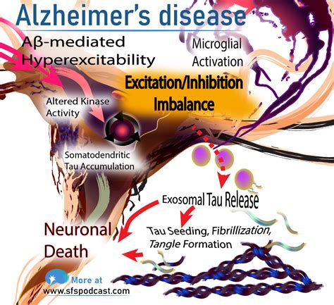 Alzheimers Disease Straight From A Scientist