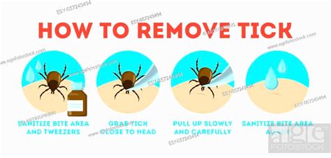 Tips For Tick Safety Infographic How To Remove Mite Insect Stock