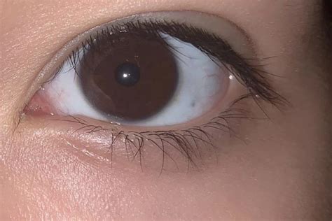 My Dark Brown Eyes Almost Look Black In Regular Light Reyes