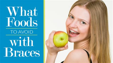 What Foods To Avoid With Braces Midwest Orthodontics Center Blog