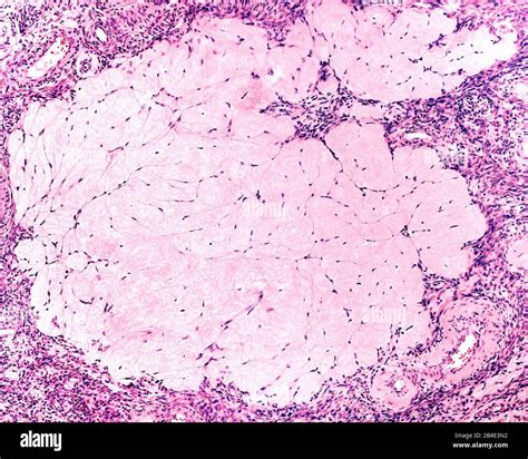 Histology ovary fotografías e imágenes de alta resolución Alamy