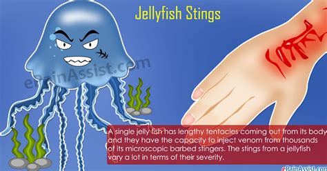 Box Jellyfish Stingwhat To Know
