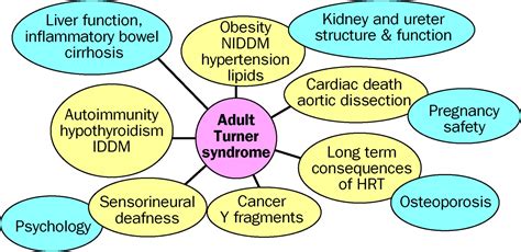 Turners Syndrome The Lancet