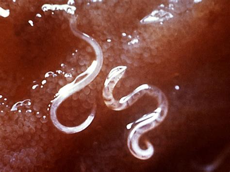Nematoda Nematodes Roundworms Animalia