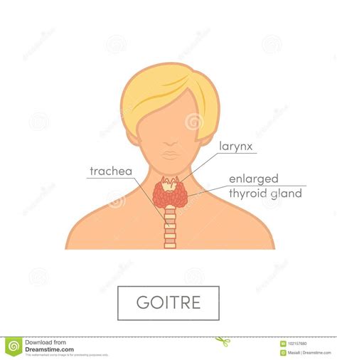 Thyroid Gland Anatomy Of Female Stock Illustration Illustration Of