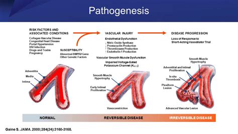 Pulmonary Arterial Hypertension Addressing Diagnostic And Therapeutic