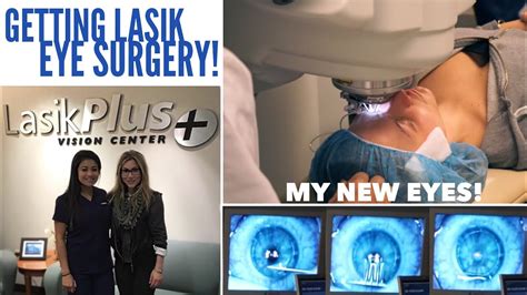 Lasik Eye Surgery My Experience Getting Lasik Plus Beeisforbeeauty