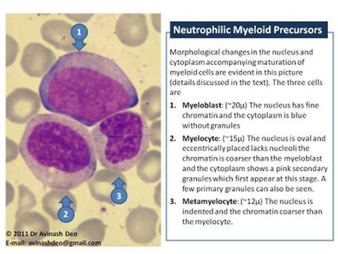The Earliest Morphologically Distinct Myeloid Cell Is A Myeloblast