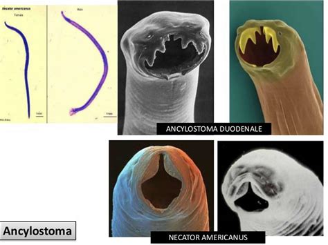 Hookworm Infection Symptoms Diagnosis And Hookworm Treatment In Humans
