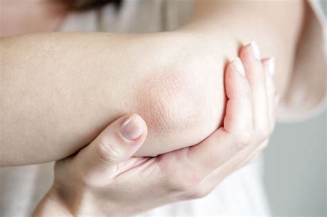 Dry Elbows What Causes Dry Elbows And How To Treat It