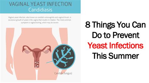 8 Things You Can Do To Prevent Yeast Infections This Summer Womenworking