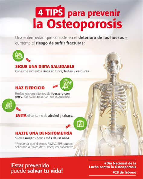 Nota Osteoporosis