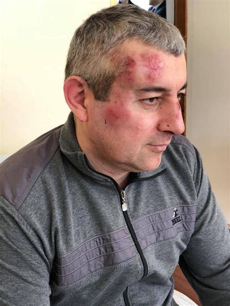 Russia Activist Attacked In Dagestan Human Rights Watch