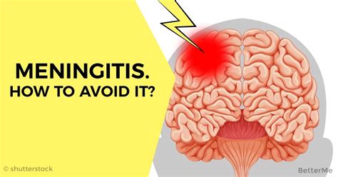Meningitis How To Avoid It