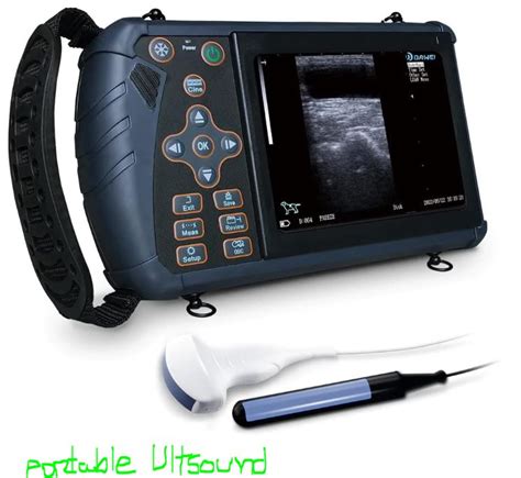 Best Handheld Portable Ultrasound Machine Physioneeds Nig