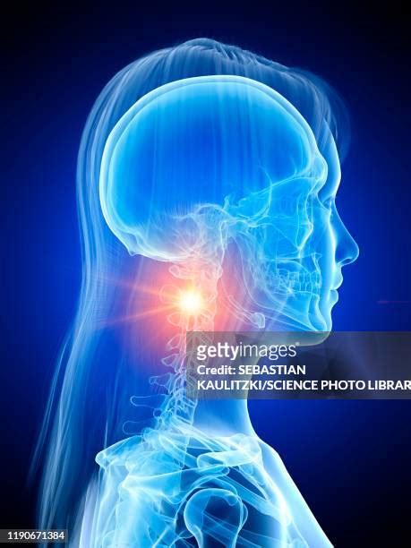 Head And Neck Anatomy Photos And Premium High Res Pictures Getty Images