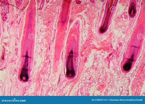 Human Hair Follicle In Skin Under The Microscope Stock Photo Image Of