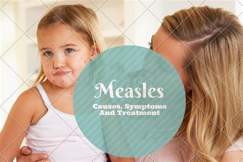 Measles Rash Causes Symptoms And Treatment