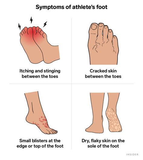 Athletes Foot Symptoms Types Causes Treatment Prevention Insider