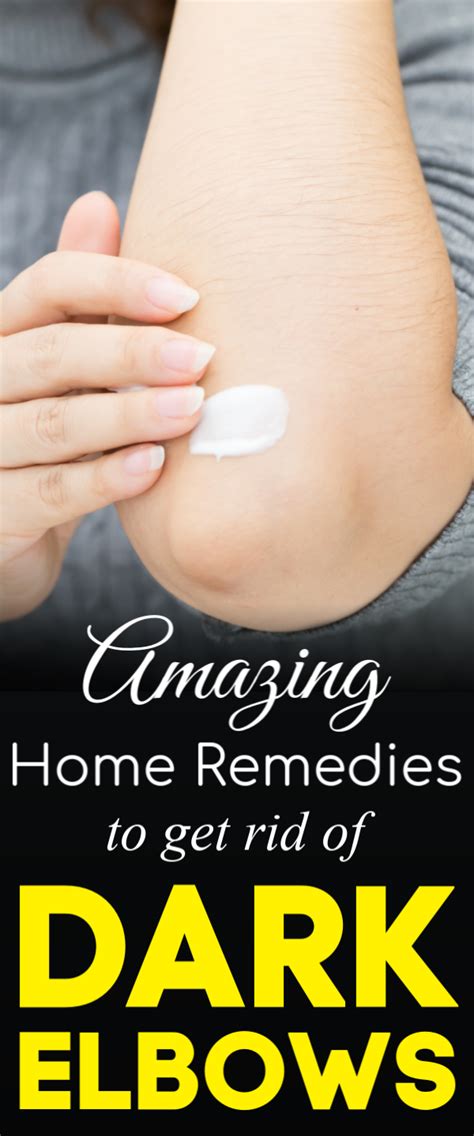 How To Get Rid Of Dark Elbows 5 Amazing Home Remedies Skinlightening