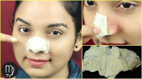Easy Diy Blackhead Remover Mask Removes Facial Hair Miss Priya Tv
